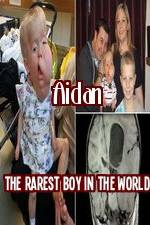 Aidan The Rarest Boy In The World