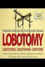 Lobotomiya