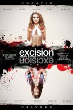 Excision