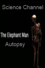 Science Channel Elephant Man Autopsy