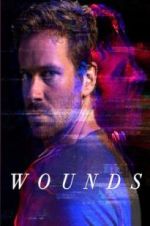 Wounds