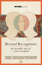 Beyond Recognition: The Incredible Story of a Face Transplant