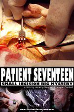 Patient Seventeen