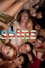 Skins (US)