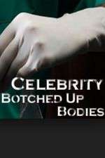 Celebrity Botched Up Bodies